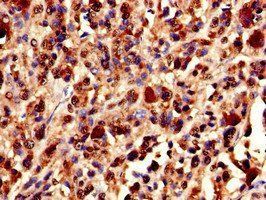 XRCC5 Antibody