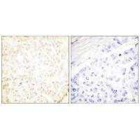 XRCC5 Antibody