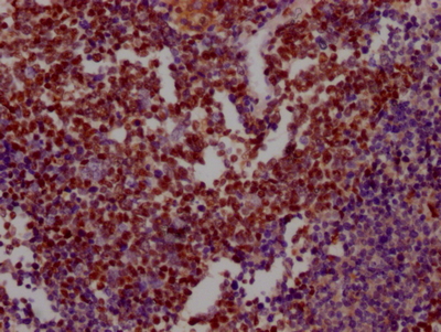 XRCC5 Recombinant Monoclonal Antibody