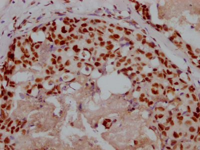 XRCC5 Recombinant Monoclonal Antibody