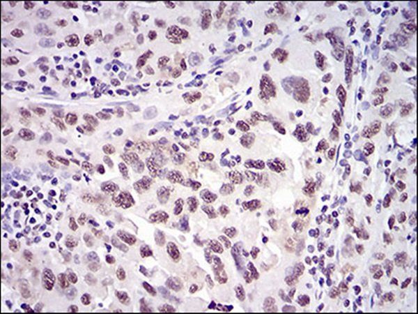 XRCC6 Antibody