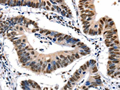 XRCC6 Antibody