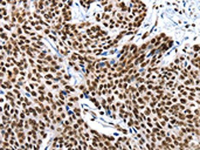 XRCC6 Antibody