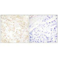 XRCC6 Antibody
