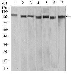 XRN2 Antibody