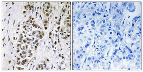 XRN2 Antibody