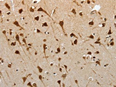 YBX1 Antibody