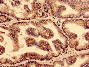 YIF1B Antibody