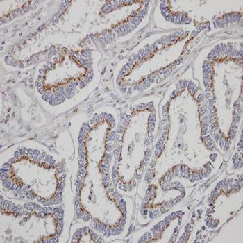 Yip1 domain family, member 4 antibody