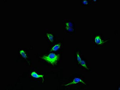 YIPF5 antibody