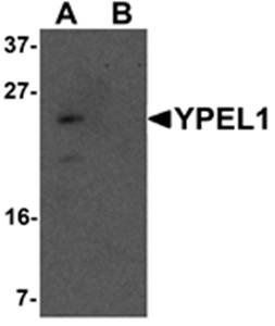 YPEL1 Rabbit Polyclonal Antibody