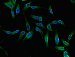 YTHDF2 Antibody