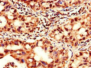 YTHDF2 Antibody