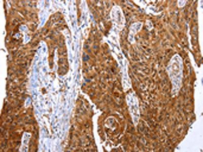 YWHAB Antibody