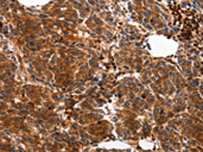 YWHAB Antibody