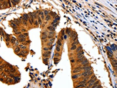 YWHAB Antibody