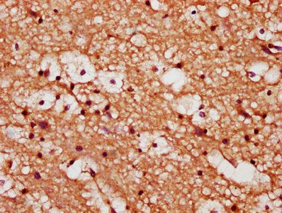 YWHAQ Antibody