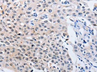 YWHAQ Antibody