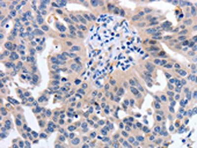 YWHAQ Antibody