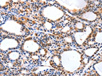 YWHAQ Antibody