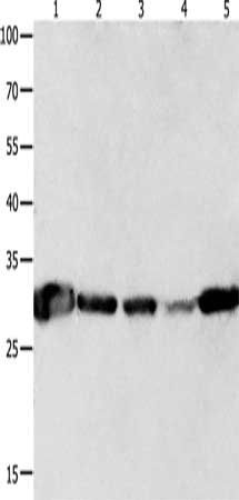 YWHAQ antibody