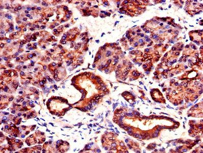 YWHAZ Antibody