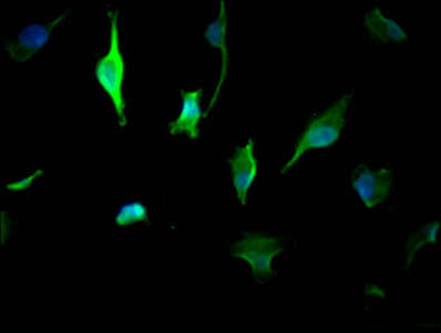 YWHAZ Monoclonal Antibody