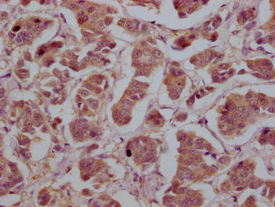 YWHAZ Monoclonal Antibody