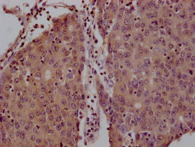 YWHAZ Monoclonal Antibody
