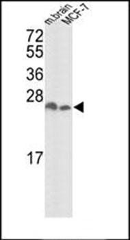 YWHAZ-D231 antibody