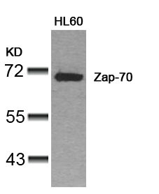ZAP70 (Ab-319) antibody