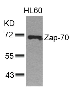 ZAP70 (Ab-493) antibody