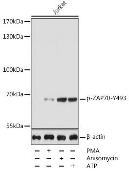 ZAP70 (Phospho-Y493) antibody