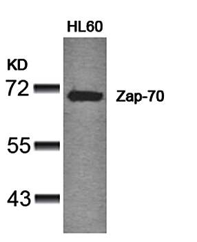 Zap-70 (Ab-319) Antibody
