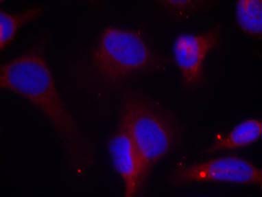 Zap-70 (Phospho-Tyr319) Antibody