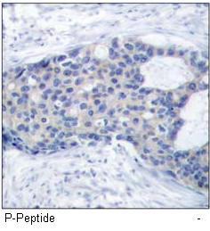 Zap-70 (Phospho-Tyr493) Antibody