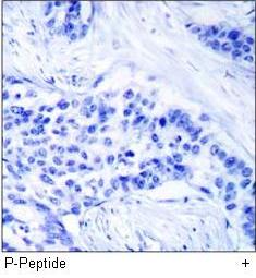 Zap-70 (Phospho-Tyr493) Antibody