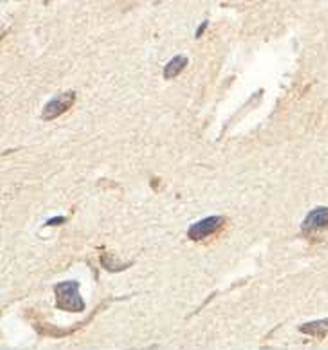 ZBED5 Rabbit Polyclonal Antibody