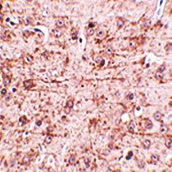 ZBTB1 Antibody