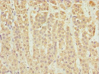 ZBTB20 Antibody