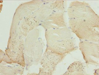ZBTB25 Antibody