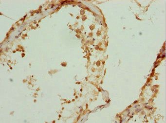 ZBTB25 Antibody