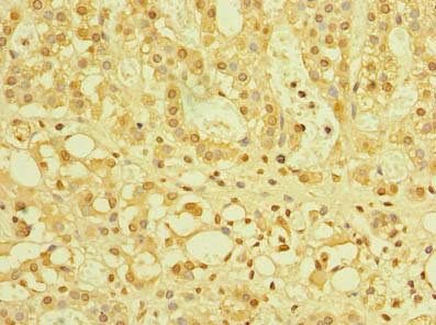ZBTB32 Antibody