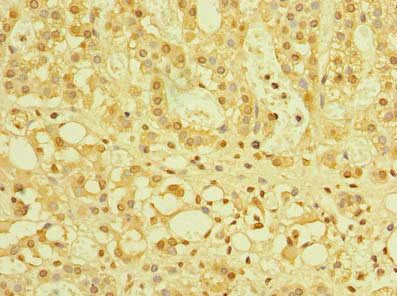 ZBTB32 antibody