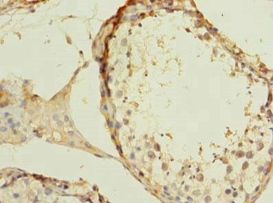 ZBTB43 Antibody