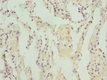 ZBTB48 Antibody