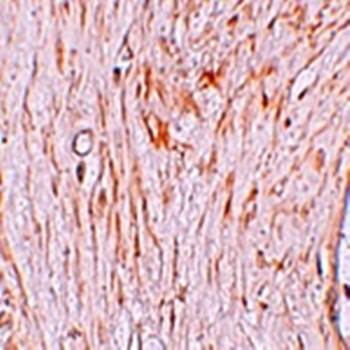 ZBTB7A Antibody