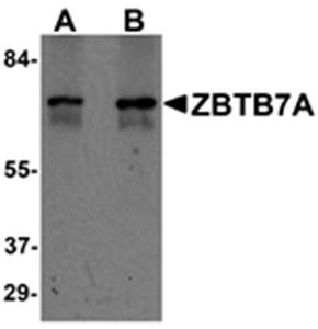 ZBTB7A Antibody