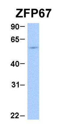 ZBTB7B antibody