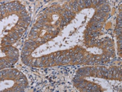 ZC3H12A Antibody